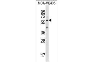 Western blot analysis in MDA-MB435 cell line lysates (35ug/lane). (Fascin 3 anticorps  (C-Term))
