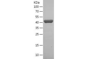 Western Blotting (WB) image for Glutamic-Oxaloacetic Transaminase 1, Soluble (Aspartate Aminotransferase 1) (GOT1) (AA 2-413) protein (His tag) (ABIN7123115)