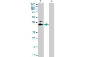 Western Blot analysis of KIAA0247 expression in transfected 293T cell line by KIAA0247 MaxPab polyclonal antibody. (SUSD6/KIAA0247 anticorps  (AA 1-303))