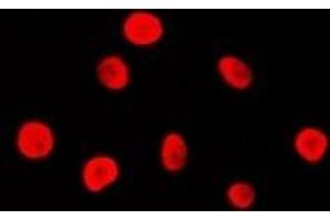 Immunofluorescent analysis of MSH2 staining in Hela cells. (MSH2 anticorps)