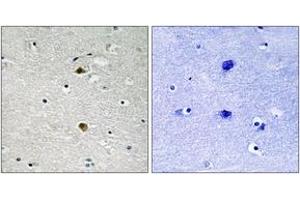 Immunohistochemistry analysis of paraffin-embedded human brain tissue, using NF-kappaB p65 (Ab-281) Antibody. (NF-kB p65 anticorps  (AA 247-296))