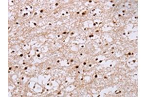 anti-Nucleoporin 50kDa (NUP50) antibody