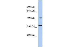 WB Suggested Anti-C11orf46 Antibody Titration: 0. (C11orf46 anticorps  (N-Term))