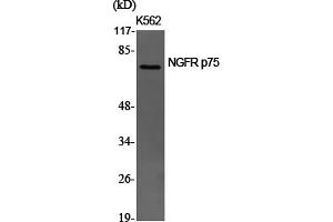 Western Blotting (WB) image for anti-Nerve Growth Factor Receptor (NGFR) (Internal Region) antibody (ABIN5956122) (NGFR anticorps  (Internal Region))