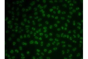 Immunofluorescence analysis of MCF7 cells using KHDRBS3 antibody (ABIN6131841, ABIN6142833, ABIN6142834 and ABIN6222332). (KHDRBS3 anticorps  (AA 177-346))