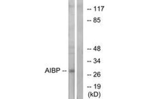 Western blot analysis of extracts from HeLa cells, using AIBP Antibody. (C1orf135 anticorps  (AA 121-170))