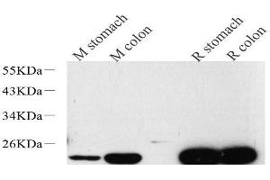 Western Blot analysis of various samples using TAGLN Polyclonal Antibody at dilution of 1:600. (Transgelin anticorps)