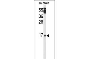 Western blot analysis of P3R2 Antibody (N-term) (ABIN653332 and ABIN2842820) in mouse brain tissue lysates (35 μg/lane). (Calcineurin B anticorps  (N-Term))