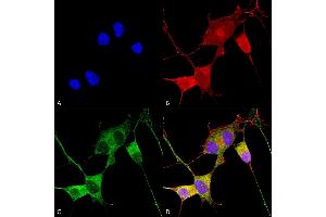 Immunocytochemistry/Immunofluorescence analysis using Mouse Anti-Ataxin 1 Monoclonal Antibody, Clone S76-8 (ABIN1741210).