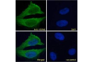 IF/ICC testing of fixed and permeabilized human HeLa cells with HSPA8 antibody (green) at 10ug/ml and DAPI nuclear stain (blue). (Hsc70 anticorps)