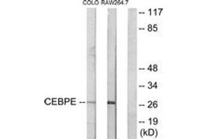 Western blot analysis of extracts from LOVO/RAW264. (CEBPD, CEBPE anticorps  (AA 171-220))
