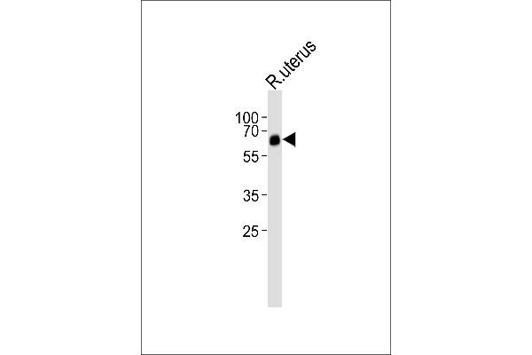 BMPR1A antibody  (N-Term)