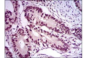 Immunohistochemistry (IHC) image for anti-E2F Transcription Factor 1 (E2F1) (AA 69-223) antibody (ABIN1845545) (E2F1 anticorps  (AA 69-223))