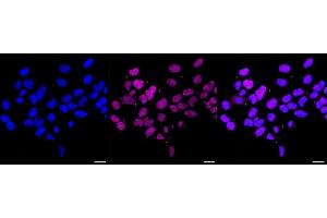 Immunocytochemical staining of HAP-1 cells with MBD3 antibody (ABIN7799389), 1:1,000).