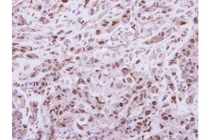 IHC-P Image Immunohistochemical analysis of paraffin-embedded H661 xenograft, using DPF2, antibody at 1:250 dilution.