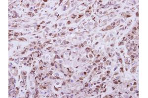 IHC-P Image Immunohistochemical analysis of paraffin-embedded H661 xenograft, using DPF2, antibody at 1:250 dilution. (DPF2 anticorps  (Center))