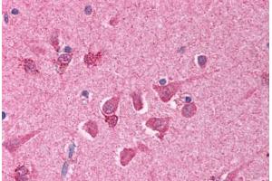 Human Brain, Cortex (formalin-fixed, paraffin-embedded) stained with BCL10 antibody ABIN214608 at 10 ug/ml followed by biotinylated goat anti-rabbit IgG secondary antibody ABIN481713, alkaline phosphatase-streptavidin and chromogen. (BCL10 anticorps  (AA 5-19))