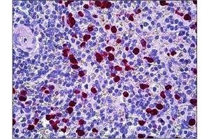 Human Spleen: Formalin-Fixed, Paraffin-Embedded (FFPE)