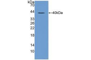 Western blot analysis of recombinant Rat MIP1a.