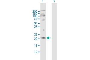 Western Blot analysis of ANAPC10 expression in transfected 293T cell line by ANAPC10 MaxPab polyclonal antibody. (ANAPC10 anticorps  (AA 1-185))