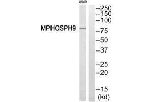 Western blot analysis of extracts from A549 cells, using MPHOSPH9 antibody. (KIF2B anticorps  (C-Term))