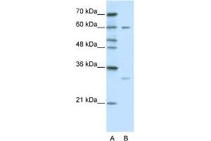 WB Suggested Anti-ZNF395 Antibody Titration:  0. (ZNF395 anticorps  (C-Term))
