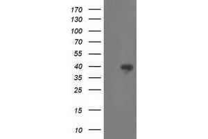 Western Blotting (WB) image for anti-Retinaldehyde Binding Protein 1 (RLBP1) antibody (ABIN1497623) (RLBP1 anticorps)
