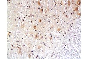 Formalin-fixed and paraffin embedded rat spinal cord tissue labeled with Anti-AQP4 Polyclonal Antibody, Unconjugated  at 1:200, followed by conjugation to the secondary antibody and DAB staining (Aquaporin 4 anticorps  (AA 271-323))