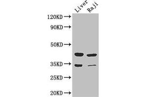 Western Blot Positive WB detected in: Mouse liver tissue, Raji whole cell lysate All lanes: BHMT2 antibody at 3 μg/mL Secondary Goat polyclonal to rabbit IgG at 1/50000 dilution Predicted band size: 41, 34 kDa Observed band size: 41, 34 kDa (BHMT2 anticorps  (AA 1-200))