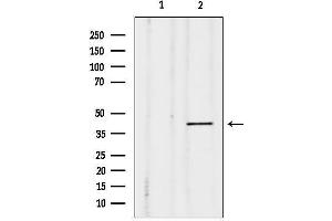 Western blot analysis of lysates from Mouse cancer, using MKP-2 Antibody.