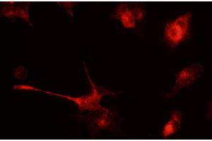 Immunofluorescence - anti-tdTomato Ab in 293HEK Cells transfected with cDNA at 1/50 dilution, cells were fixed with 4% of PFA, (tdTomato anticorps)