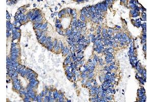 IHC analysis of TOMM70 using anti-TOMM70 antibody (ABIN7599855). (TOM70 anticorps  (AA 122-608))