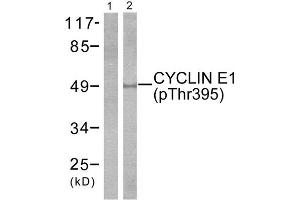 Western Blotting (WB) image for anti-Cyclin E1 (CCNE1) (pThr395) antibody (ABIN1847246) (Cyclin E1 anticorps  (pThr395))
