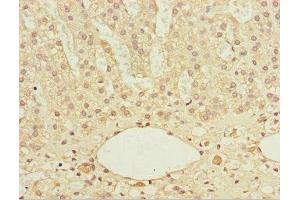 Immunohistochemistry of paraffin-embedded human adrenal gland tissue using ABIN7172122 at dilution of 1:100