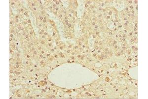 Immunohistochemistry of paraffin-embedded human adrenal gland tissue using ABIN7172122 at dilution of 1:100 (DTYMK anticorps  (AA 1-212))