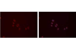 ABIN6277410 staining Hela cells by IF/ICC.