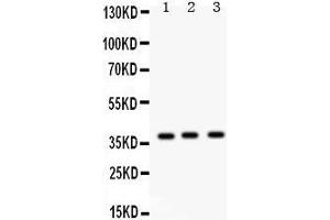 Western Blotting (WB) image for anti-Surfactant Protein D (SFTPD) (AA 292-321), (C-Term) antibody (ABIN3043335) (SFTPD anticorps  (C-Term))