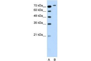 WB Suggested Anti-RHOBTB1 Antibody Titration:  0. (RHOBTB1 anticorps  (Middle Region))