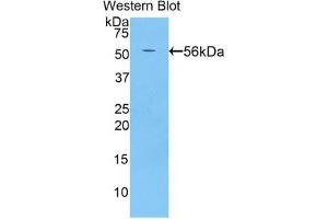 Detection of Recombinant BACE2, Rat using Polyclonal Antibody to Beta Secretase 2 (BACE2)