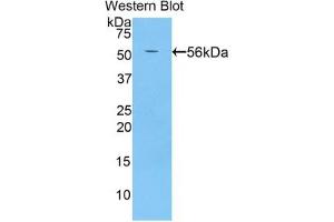 Detection of Recombinant BACE2, Rat using Polyclonal Antibody to Beta Secretase 2 (BACE2) (BACE2 anticorps  (AA 242-502))