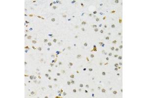 Immunohistochemistry of paraffin-embedded rat brain using SETDB1 antibody.