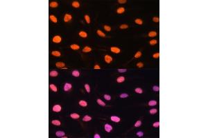 Immunofluorescence analysis of U-2 OS cells using ZBED1 antibody (ABIN6132791, ABIN6150363, ABIN6150364 and ABIN6222539) at dilution of 1:100.
