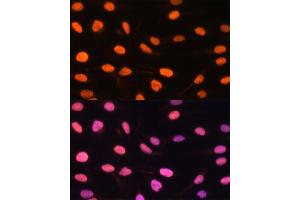 Immunofluorescence analysis of U-2 OS cells using ZBED1 antibody (ABIN6132791, ABIN6150363, ABIN6150364 and ABIN6222539) at dilution of 1:100. (ZBED1 anticorps  (AA 1-280))