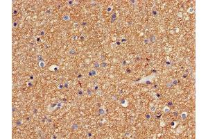 Immunohistochemistry of paraffin-embedded human brain tissue using ABIN7154472 at dilution of 1:100 (GADD45G anticorps  (AA 1-159))