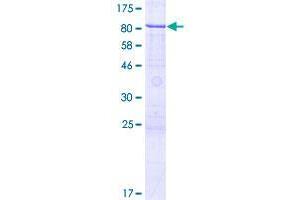 Image no. 1 for Zinc Finger Protein 530 (ZNF530) (AA 1-599) protein (GST tag) (ABIN1326267)