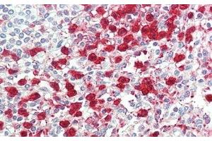 Detection of ITGb6 in Human Spleen Tissue using Polyclonal Antibody to Integrin Beta 6 (ITGb6)