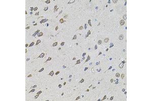 Immunohistochemistry of paraffin-embedded rat brain using FOXO3 antibody (ABIN2736768) at dilution of 1:100 (40x lens). (FOXO3 anticorps)