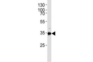 Western blot analysis of lysate from HUVEC cell line using Gapdh antibody.