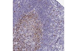 Immunohistochemical staining of human lymph node with IFITM1 polyclonal antibody  shows strong cytoplasmic positivity in lymphoid cells outside reaction centra at 1:200-1:500 dilution. (TIPIN anticorps)