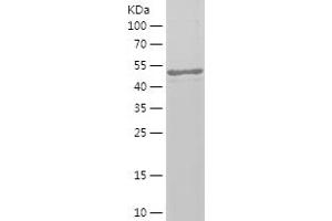 Western Blotting (WB) image for PAP Associated Domain Containing 5 (PAPD5) (AA 1-196) protein (His-IF2DI Tag) (ABIN7124306) (PAPD5 Protein (AA 1-196) (His-IF2DI Tag))